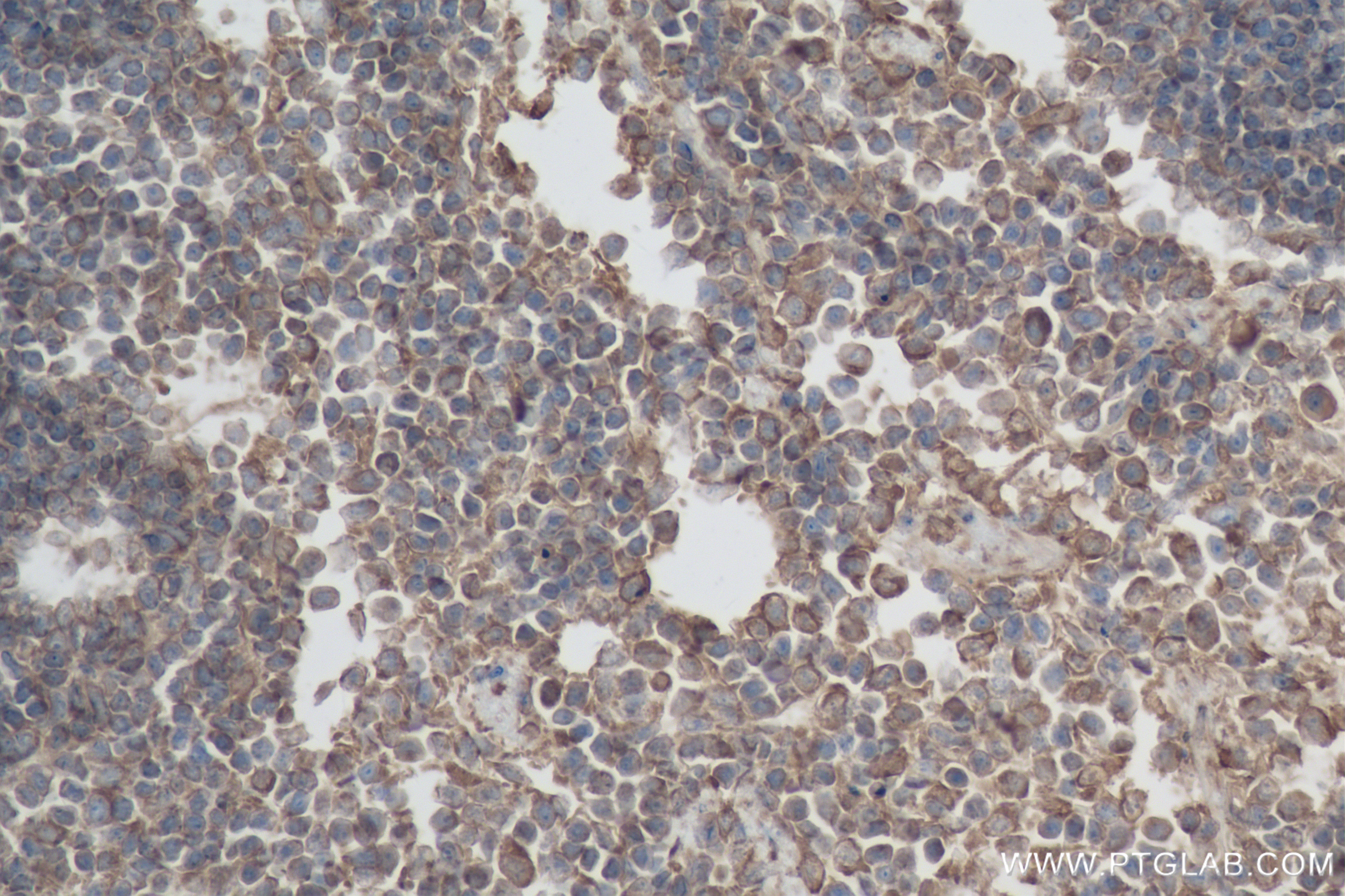 IHC staining of mouse spleen using 83562-3-RR (same clone as 83562-3-PBS)