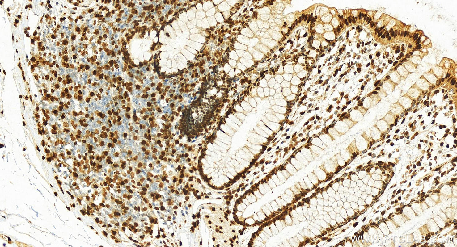 IHC staining of human colon using 17510-1-AP