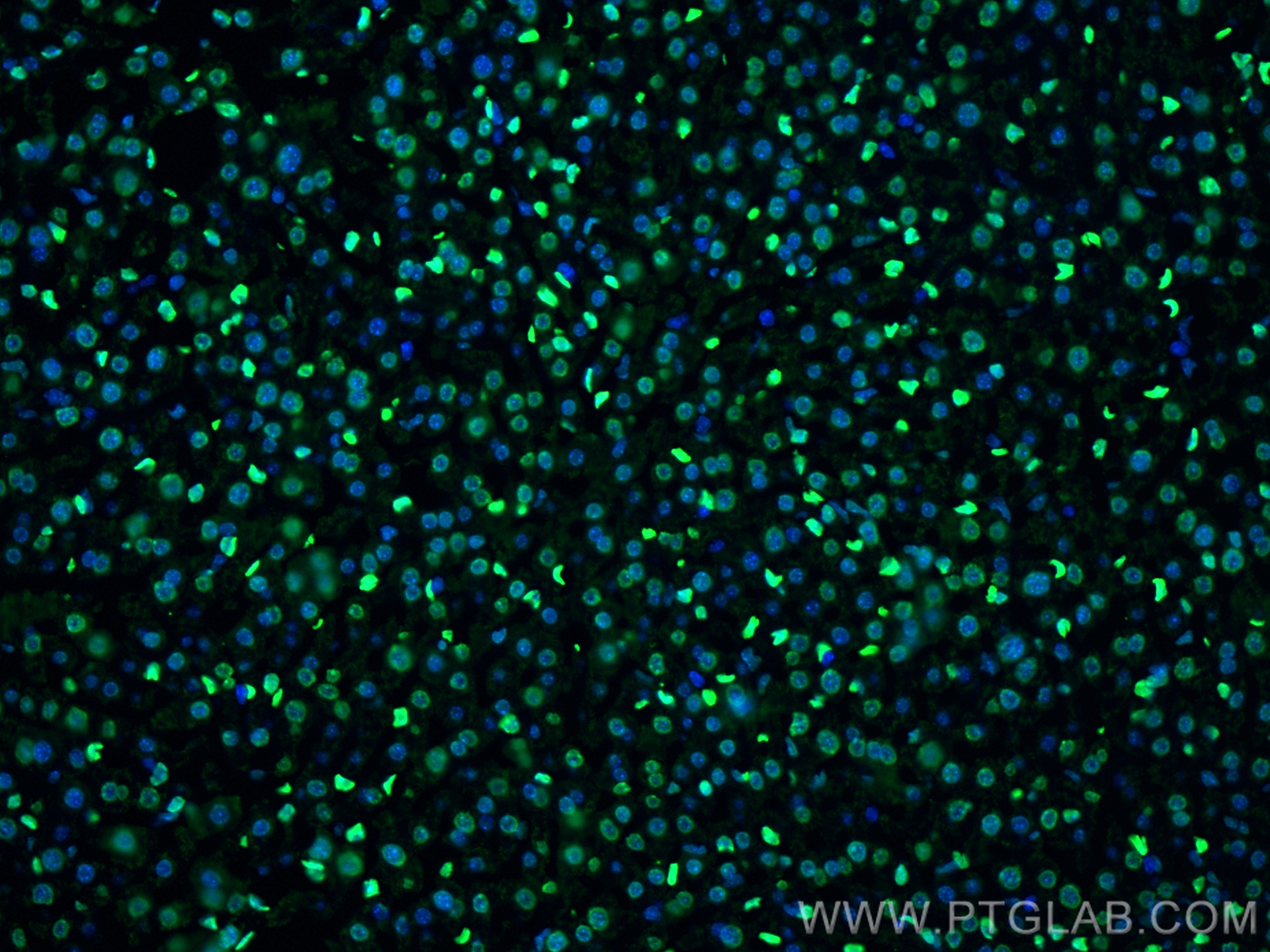 IF Staining of mouse liver using 17510-1-AP