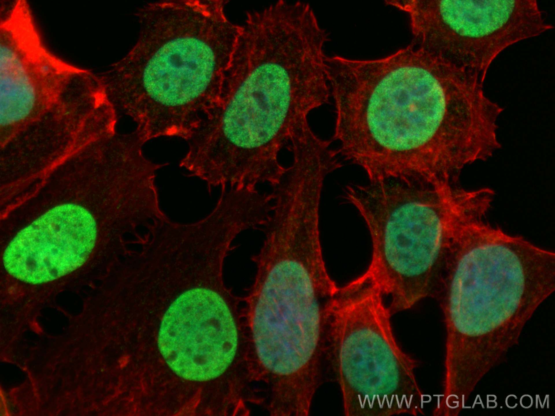 IF Staining of MCF-7 using 10856-1-AP