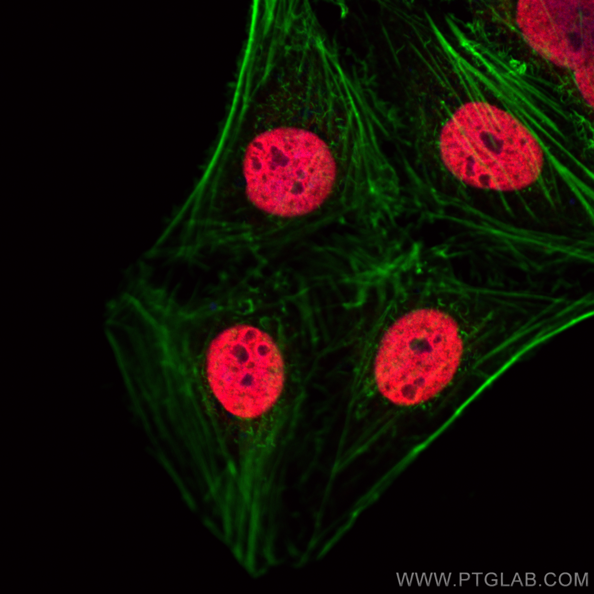 IF Staining of U2OS using 10856-1-AP