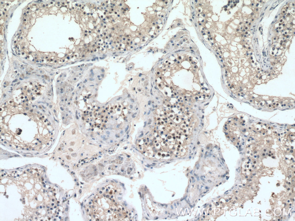 IHC staining of human testis using 16441-1-AP