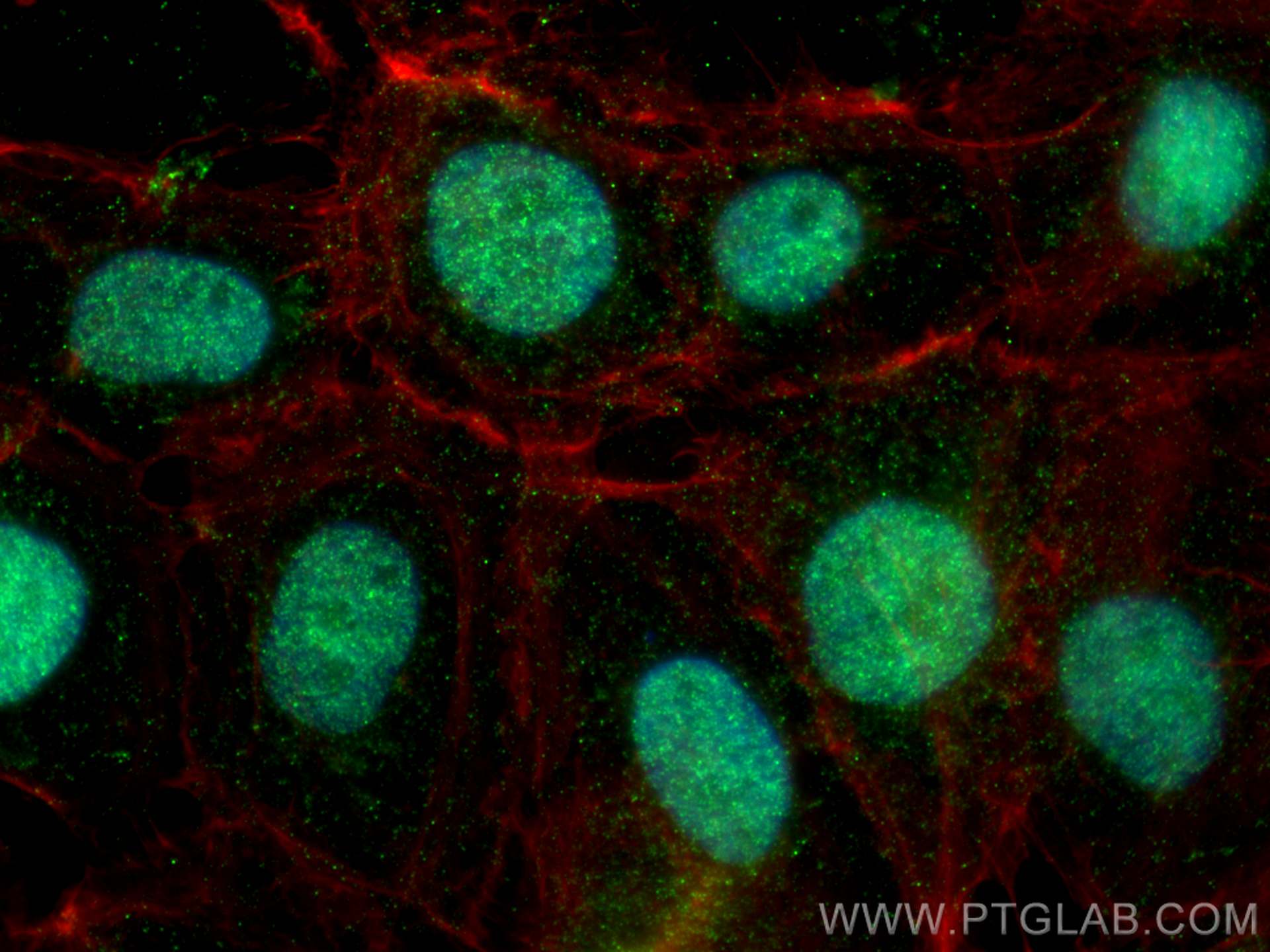 IF Staining of A431 using 13754-1-AP