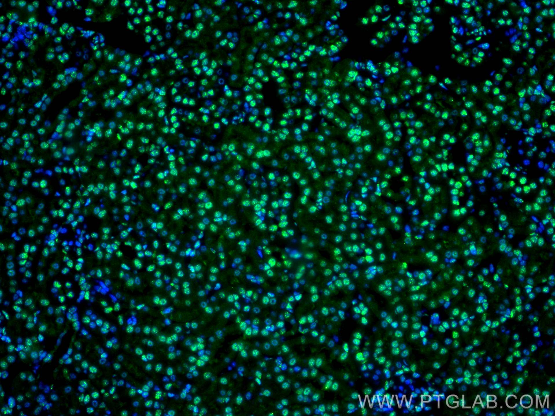 IF Staining of mouse kidney using 66863-1-Ig (same clone as 66863-1-PBS)