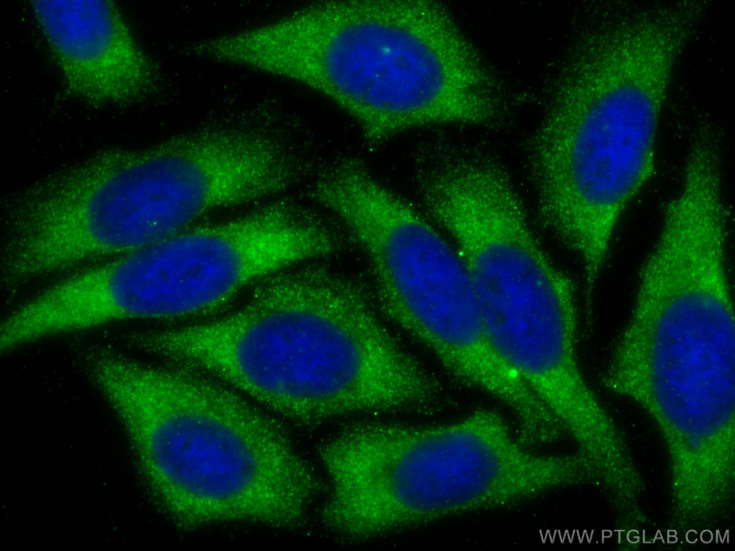 IF Staining of HepG2 using 67867-1-Ig