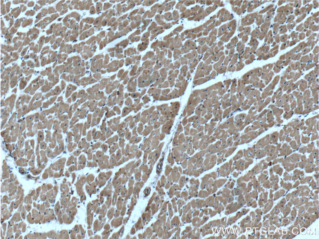 IHC staining of human heart using 24104-1-AP