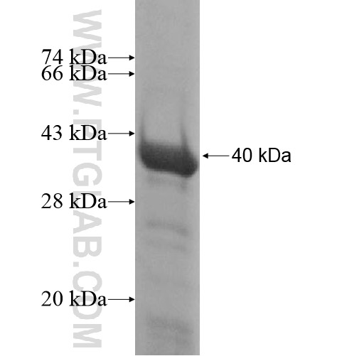 HADH fusion protein Ag13976 SDS-PAGE