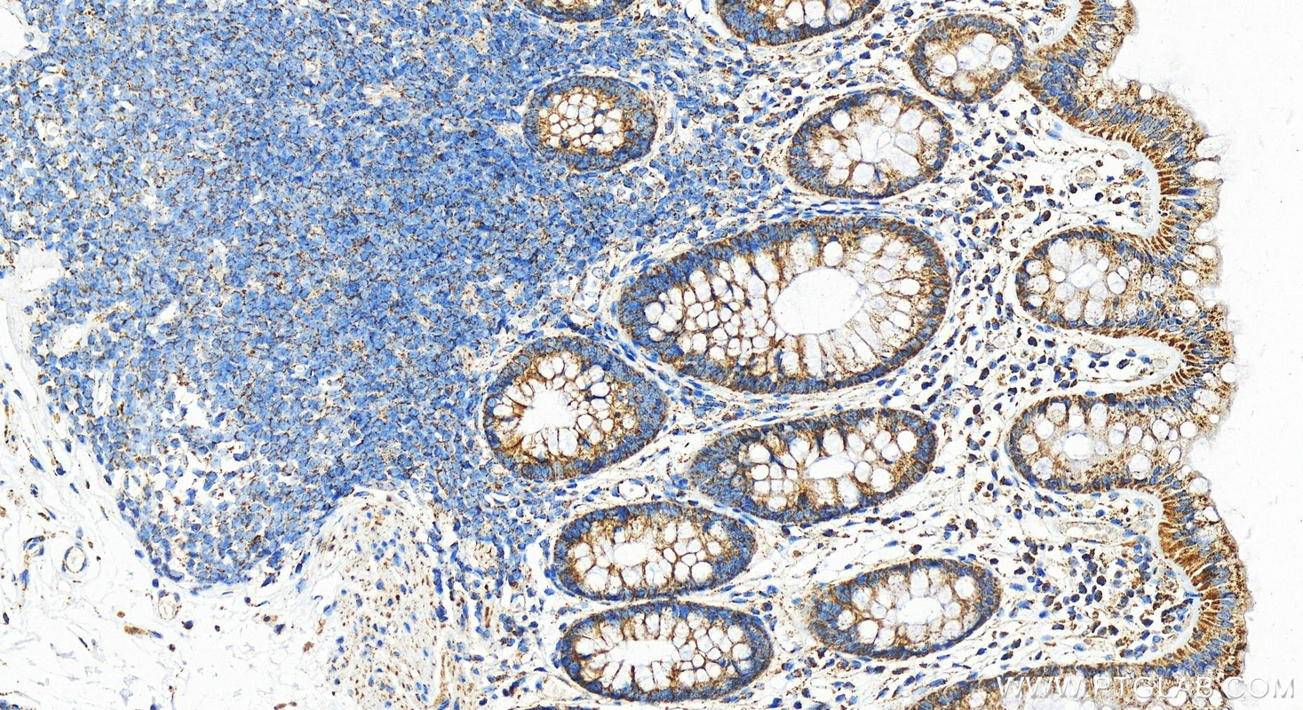 IHC staining of human colon using 10758-1-AP