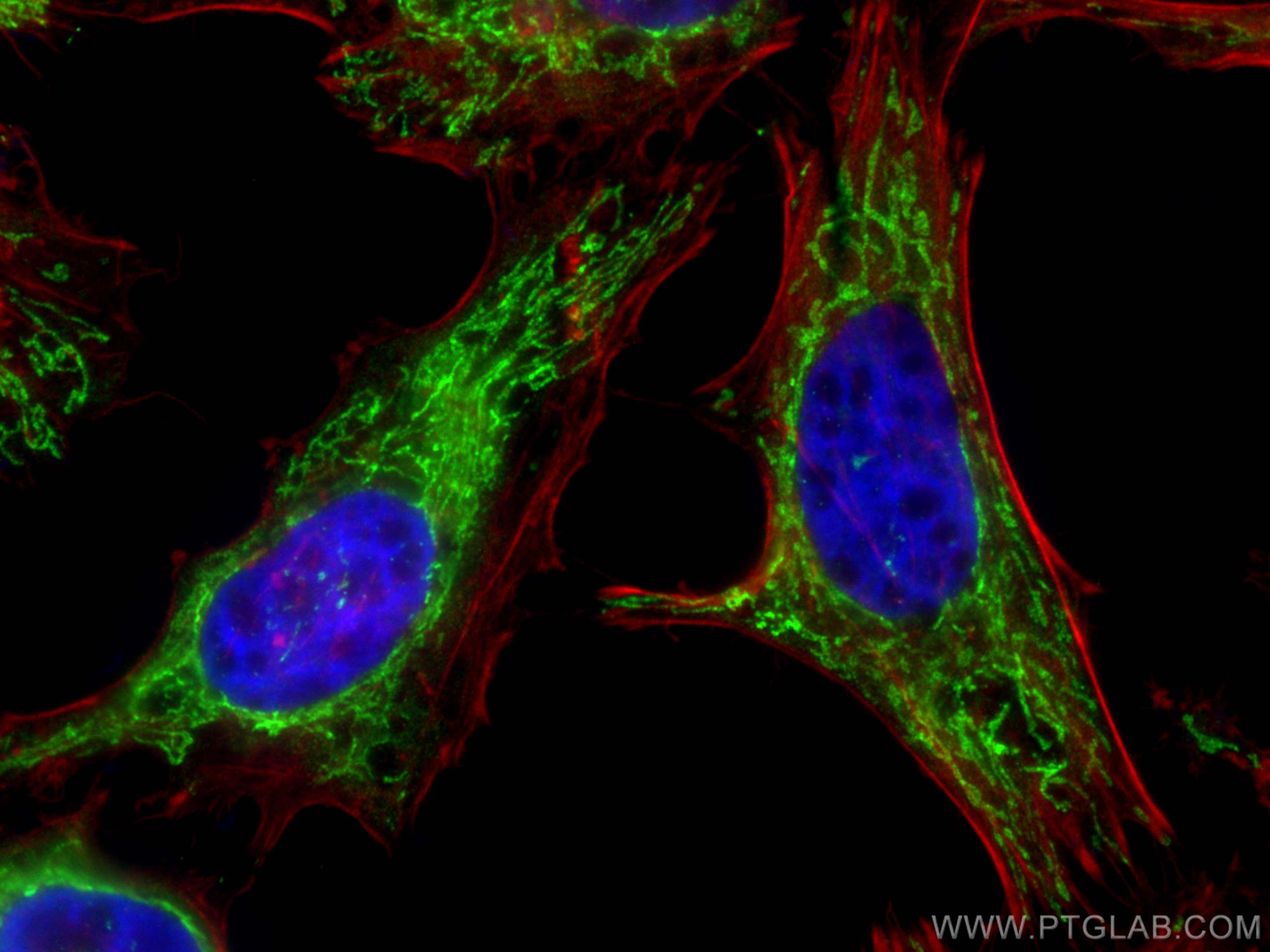 IF Staining of HeLa using 10758-1-AP