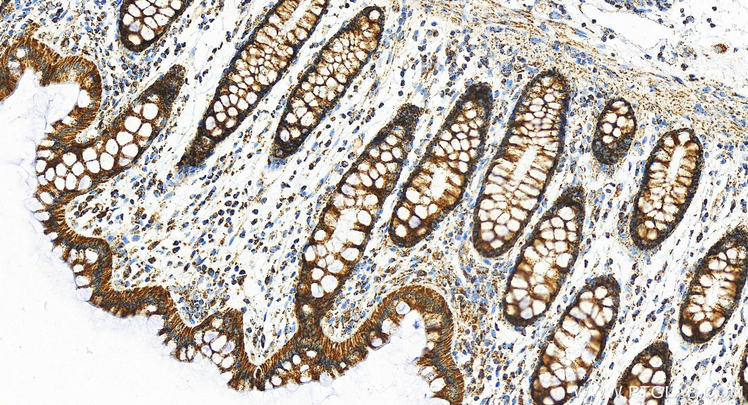 IHC staining of human  colon using 29091-1-AP