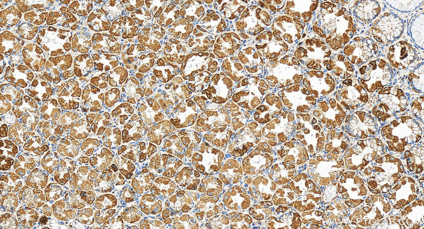 IHC staining of human stomach using 29091-1-AP