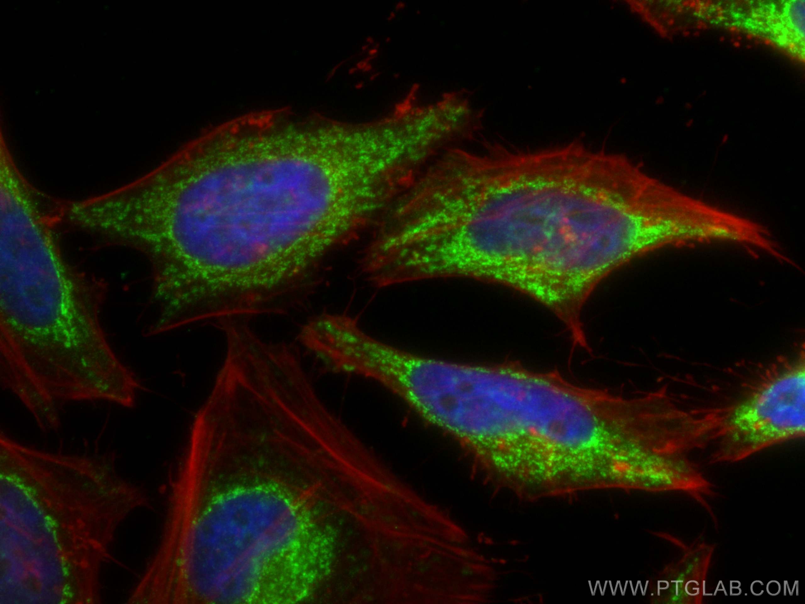 IF Staining of HeLa using 67967-1-Ig (same clone as 67967-1-PBS)