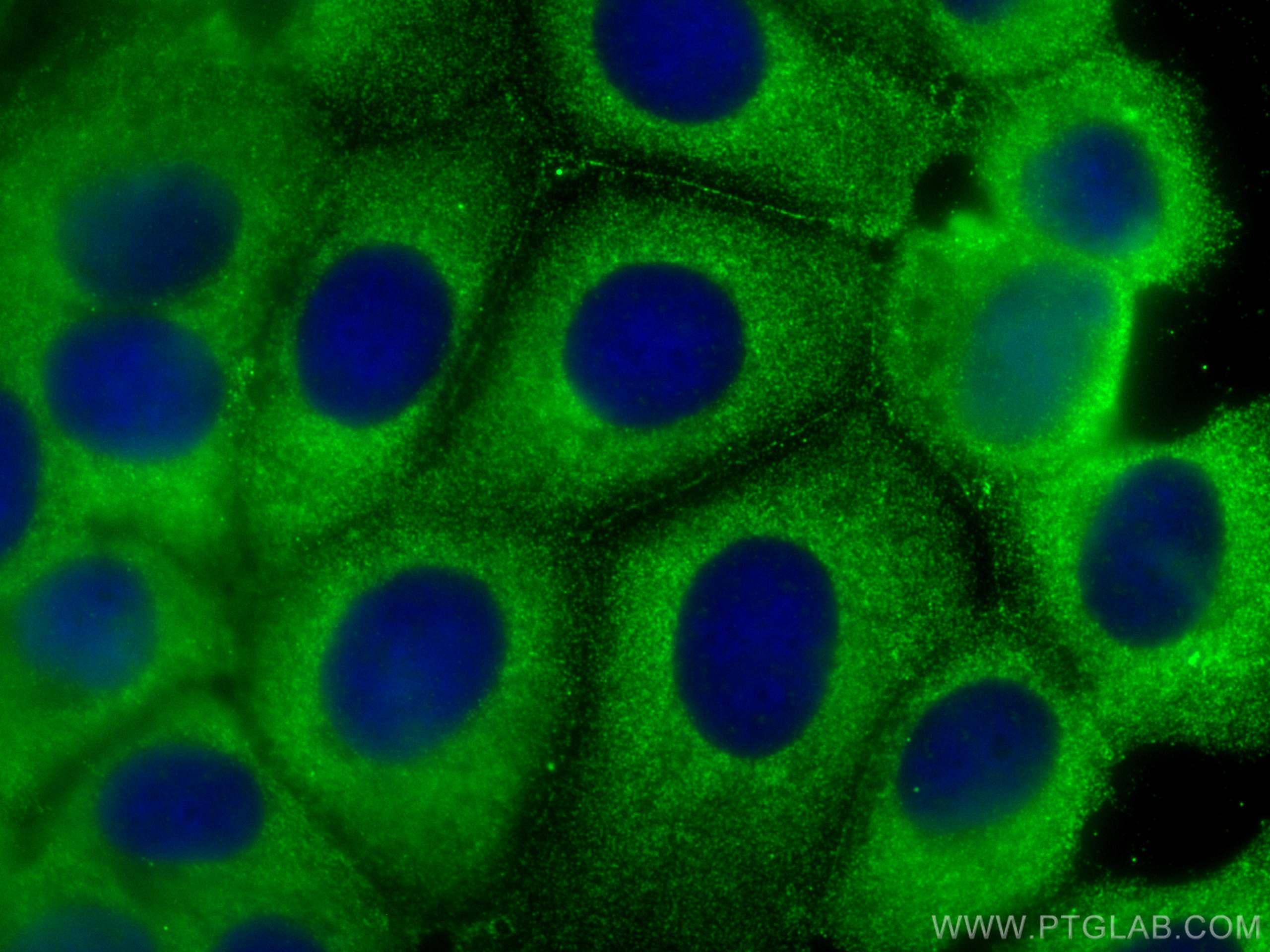 IF Staining of MCF-7 using 67031-1-Ig (same clone as 67031-1-PBS)