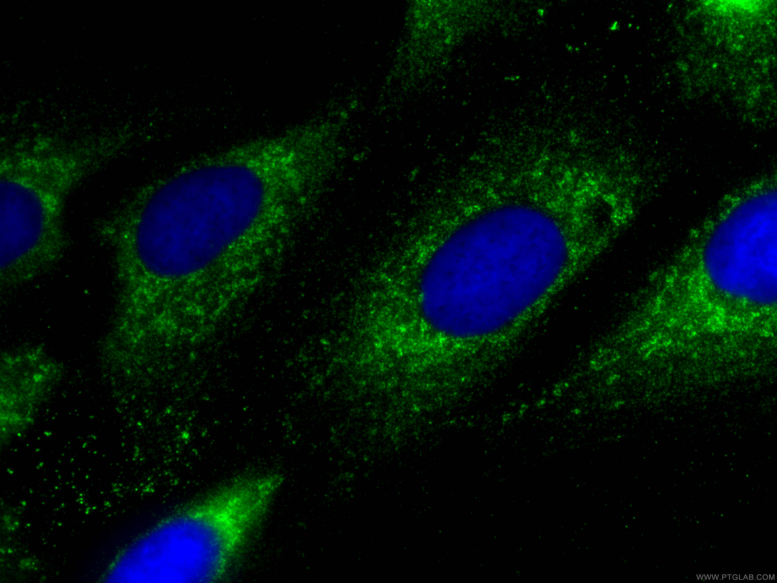 IF Staining of U2OS using 26831-1-AP