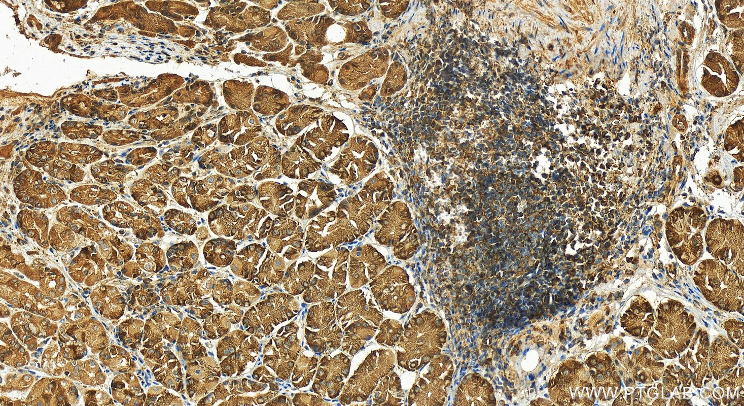 IHC staining of human stomach using 16375-1-AP