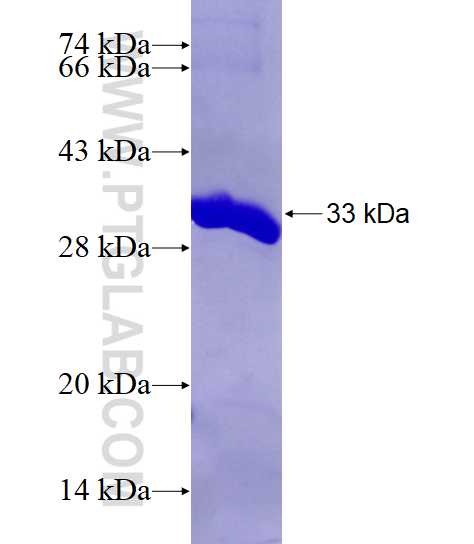 HARS fusion protein Ag9224 SDS-PAGE