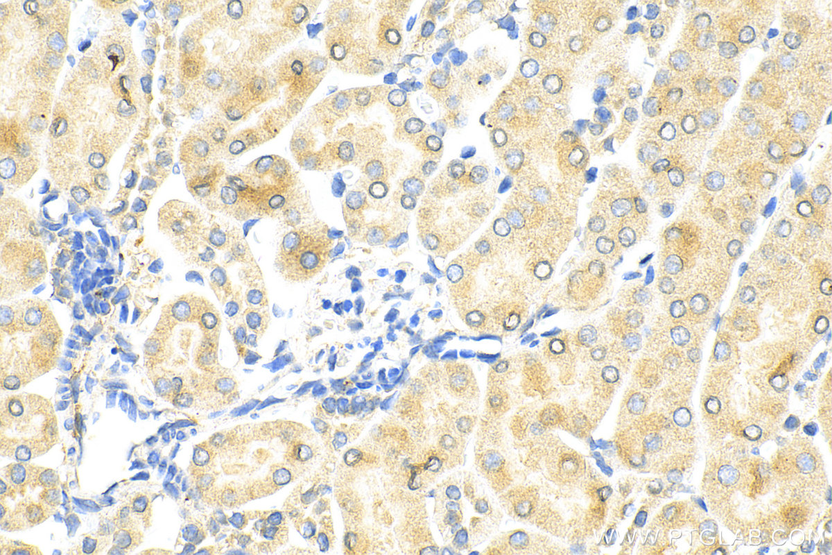 IHC staining of mouse kidney using 30948-1-AP