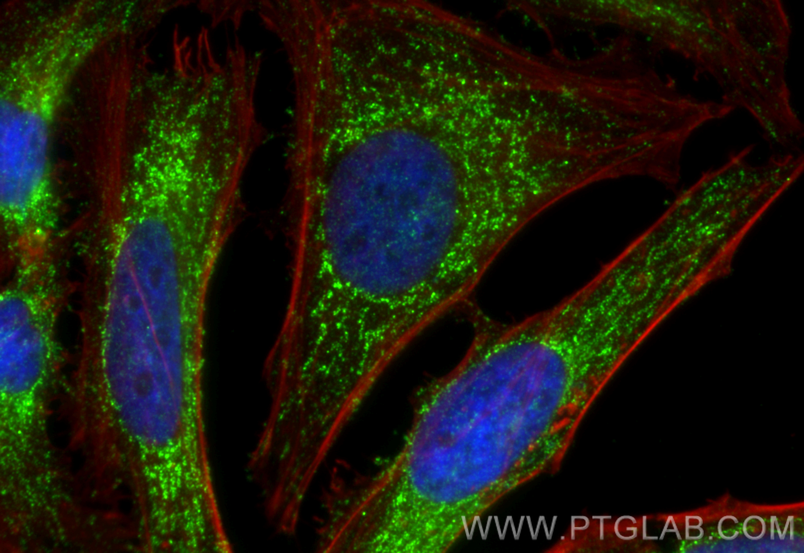 IF Staining of HeLa using 11266-1-AP