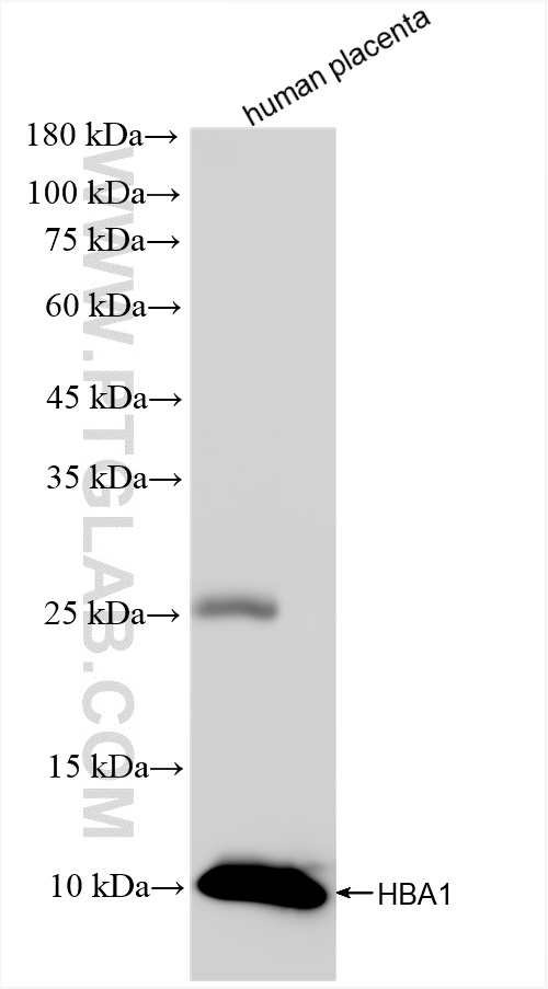 WB analysis of human placenta using 83185-5-RR (same clone as 83185-5-PBS)