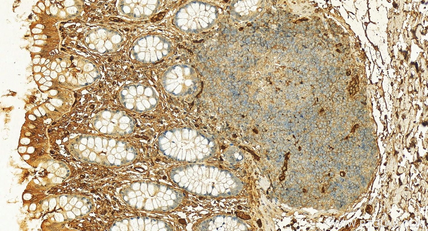 IHC staining of human  colon using 19990-1-AP