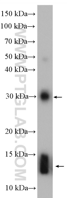 WB analysis of human placenta using 19990-1-AP