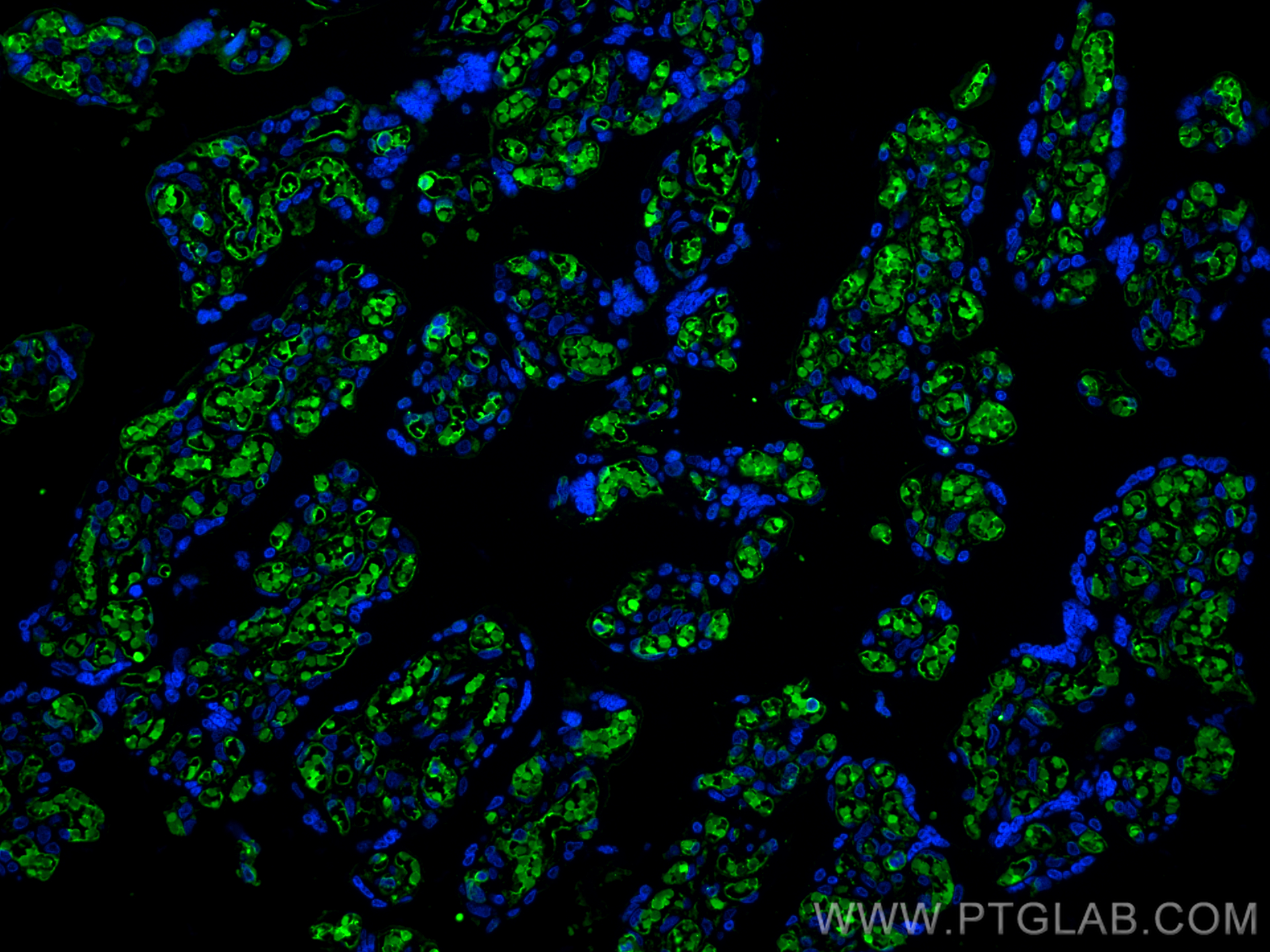 IF Staining of human placenta using 16216-1-AP