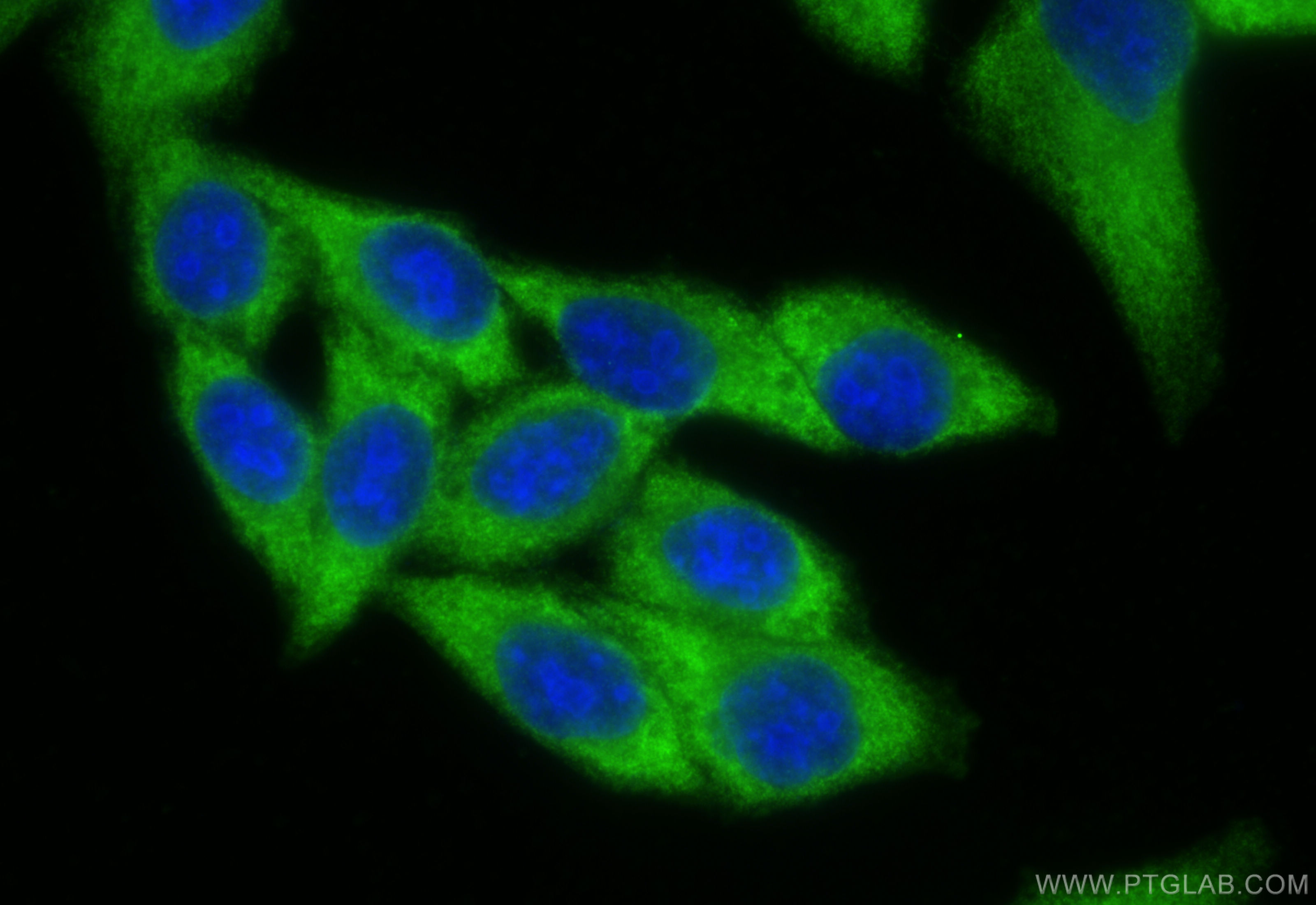 IF Staining of HepG2 using 10359-1-AP