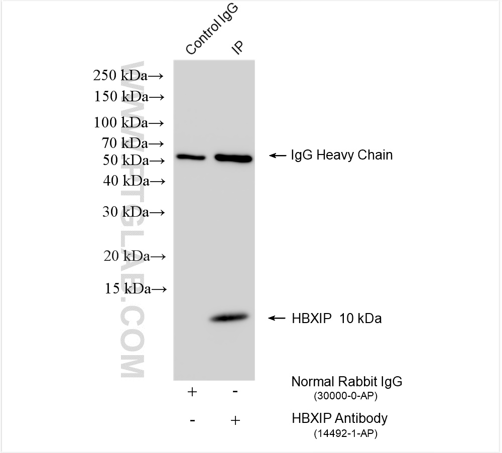 IP experiment of K-562 using 14492-1-AP