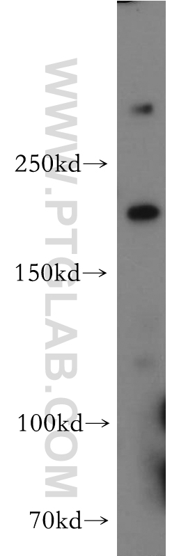 WB analysis of HEK-293 using 19358-1-AP