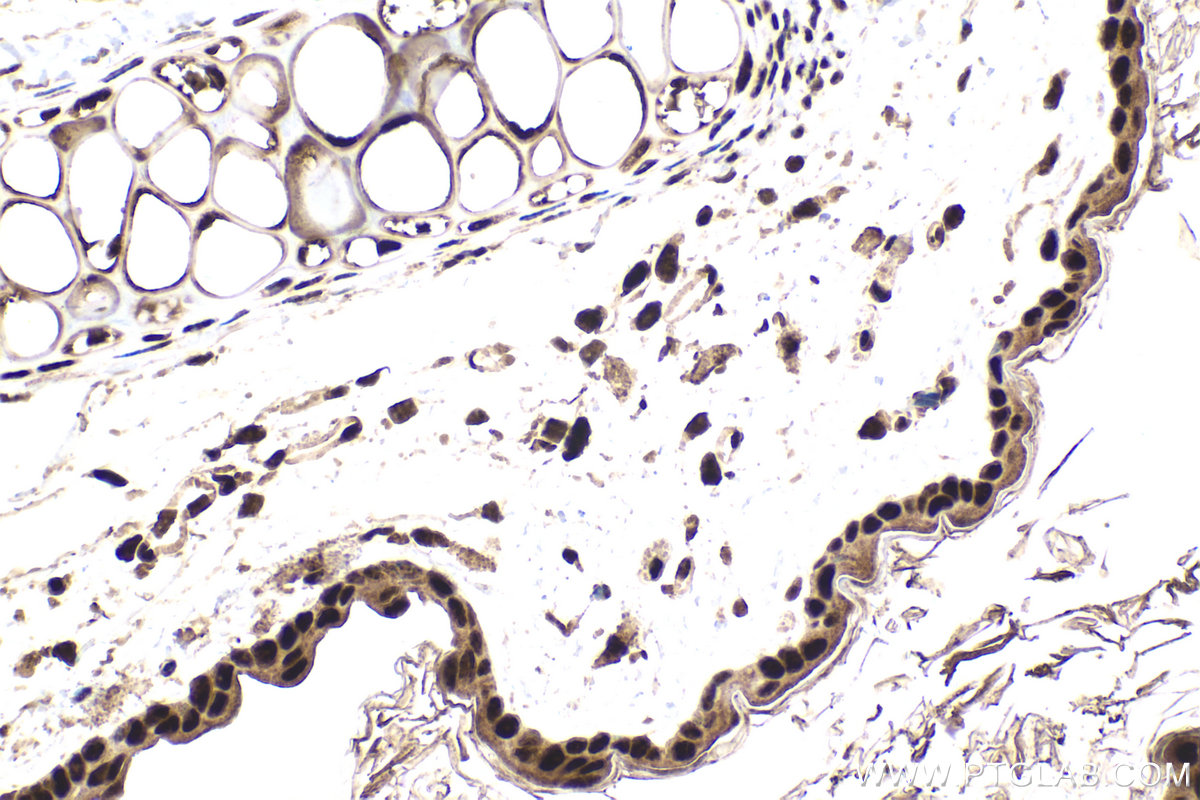 IHC staining of mouse skin using 28569-1-AP