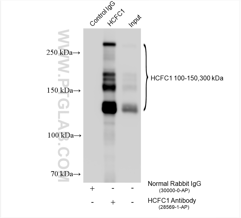 IP experiment of HeLa using 28569-1-AP (same clone as 28569-1-PBS)