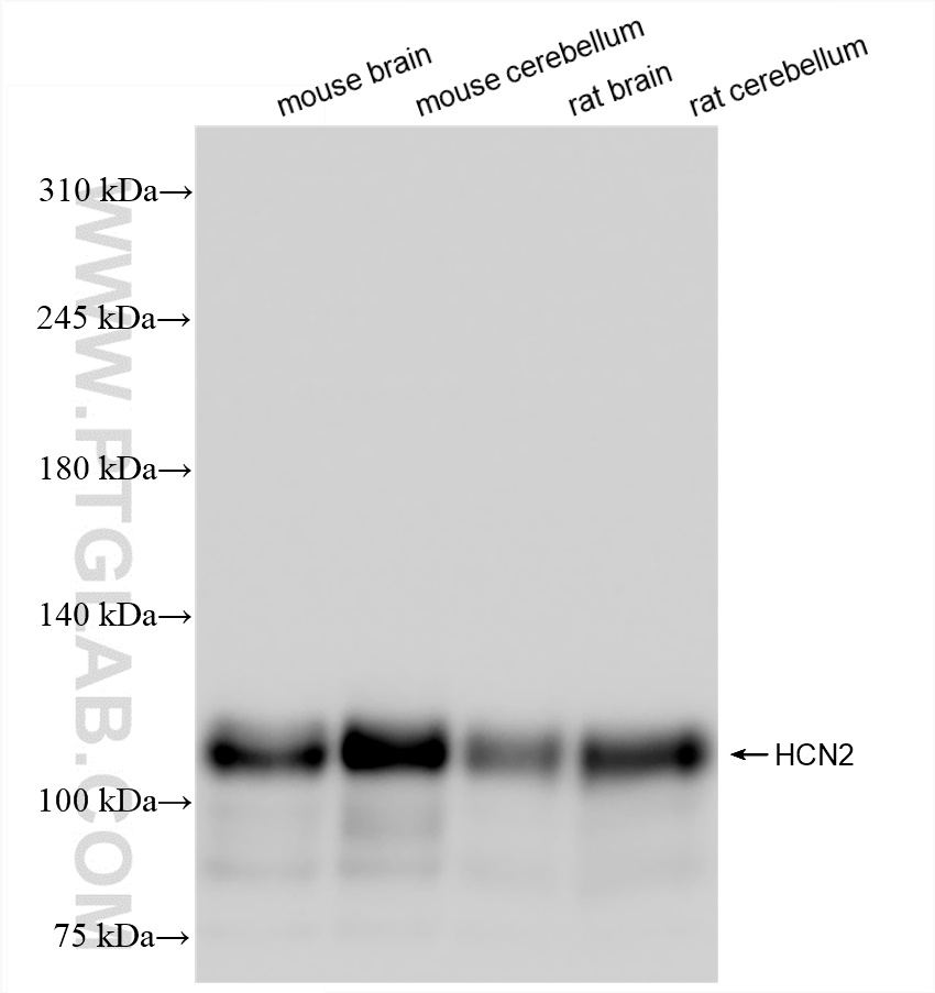 WB analysis using 84308-3-RR