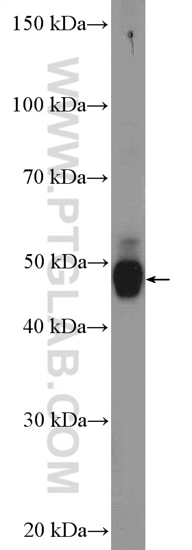 WB analysis of mouse brain using 18370-1-AP