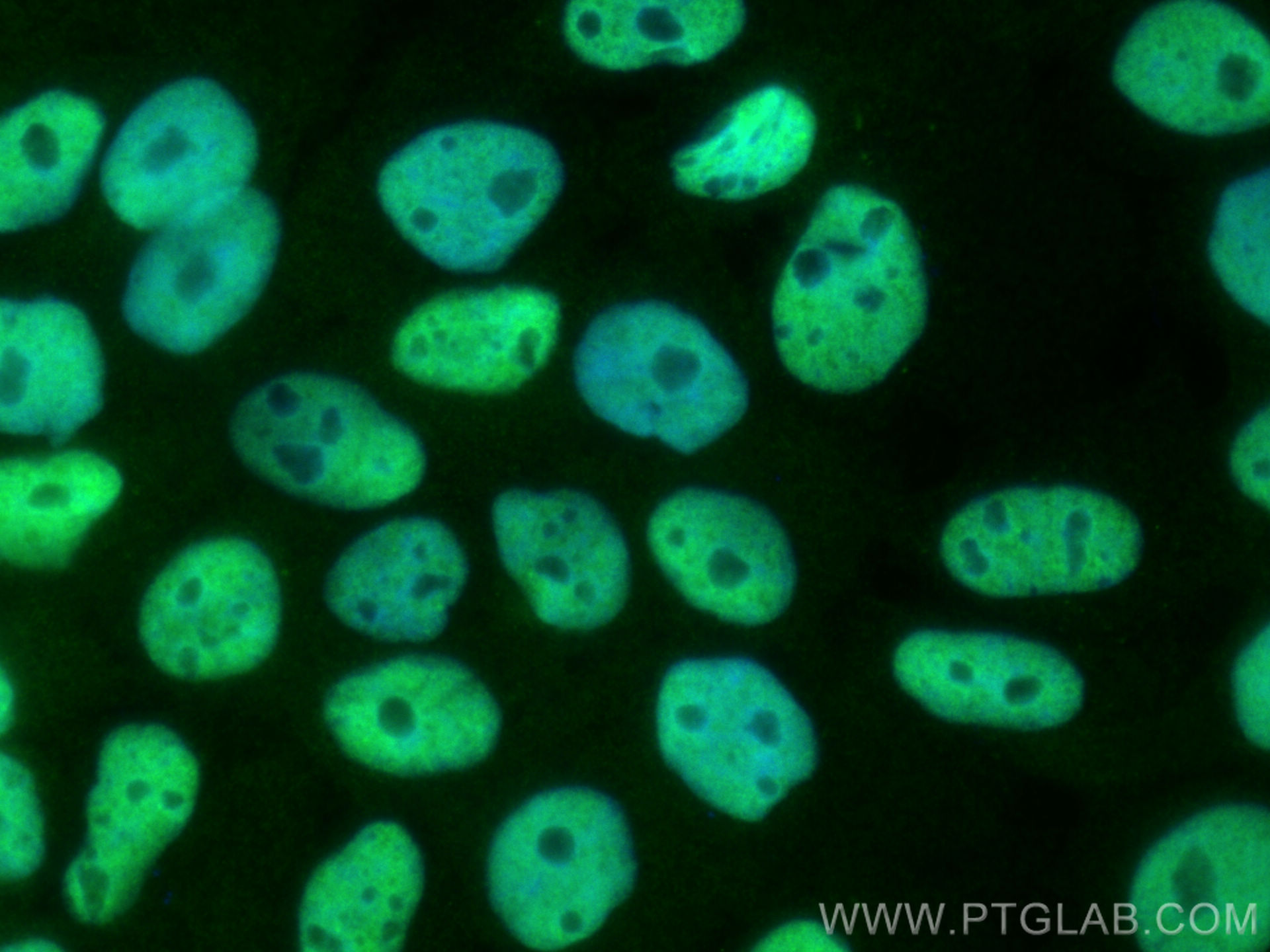 IF Staining of A431 using 10197-1-AP