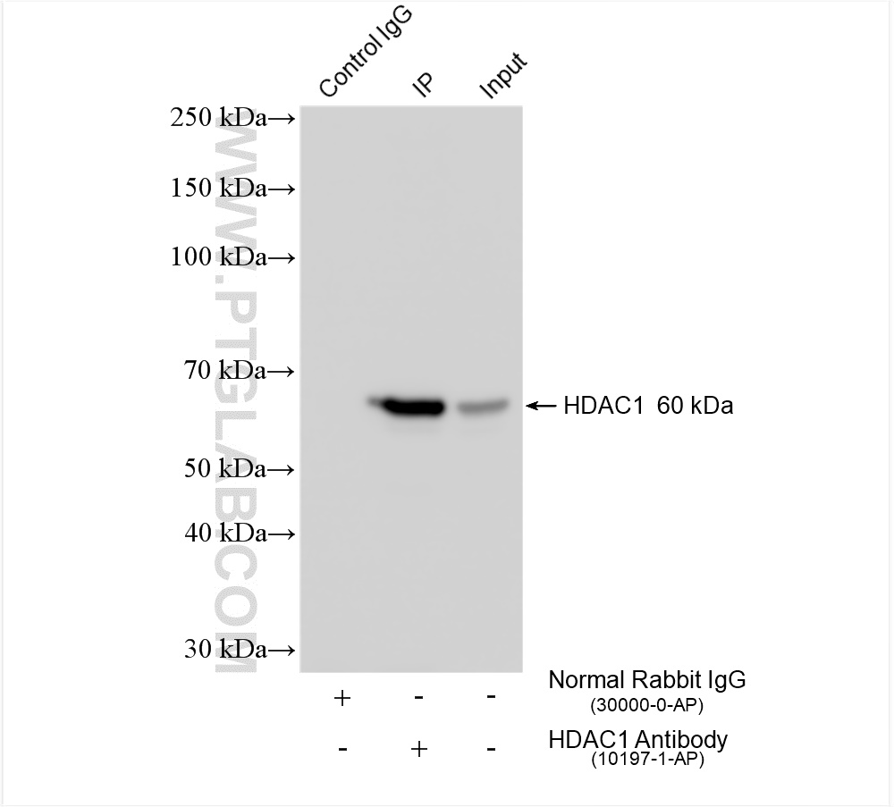 IP experiment of HeLa using 10197-1-AP