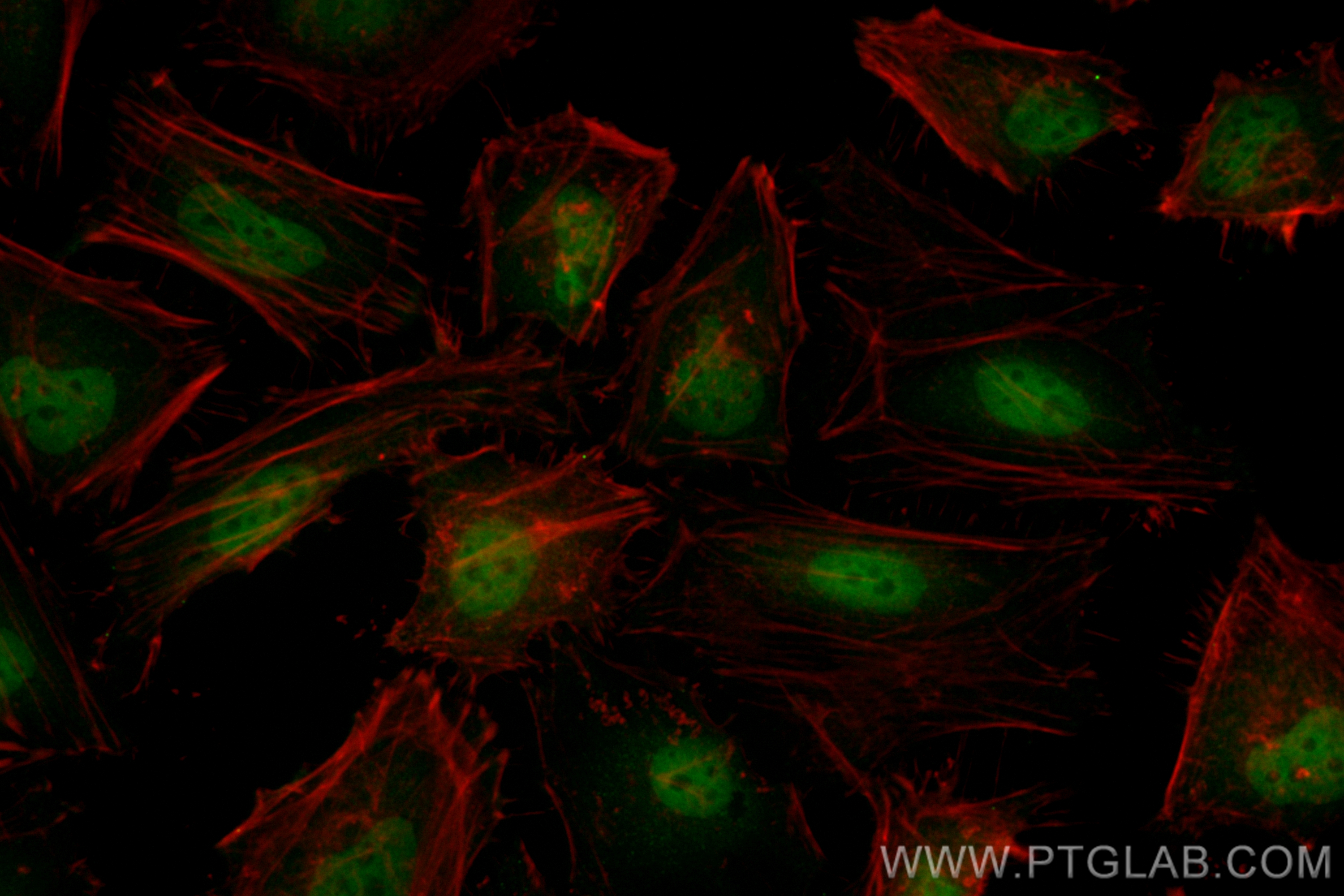 IF Staining of HeLa using CL488-83624