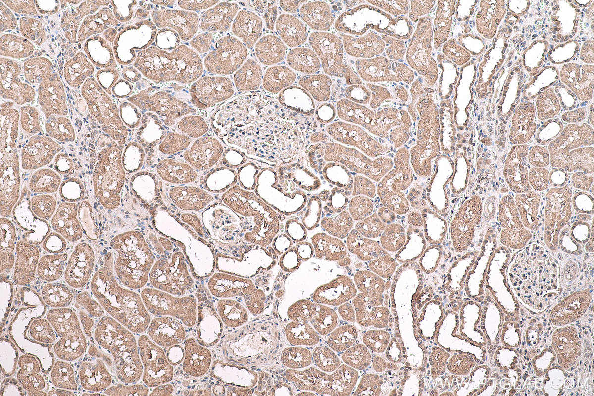 IHC staining of human kidney using 67949-1-Ig (same clone as 67949-1-PBS)