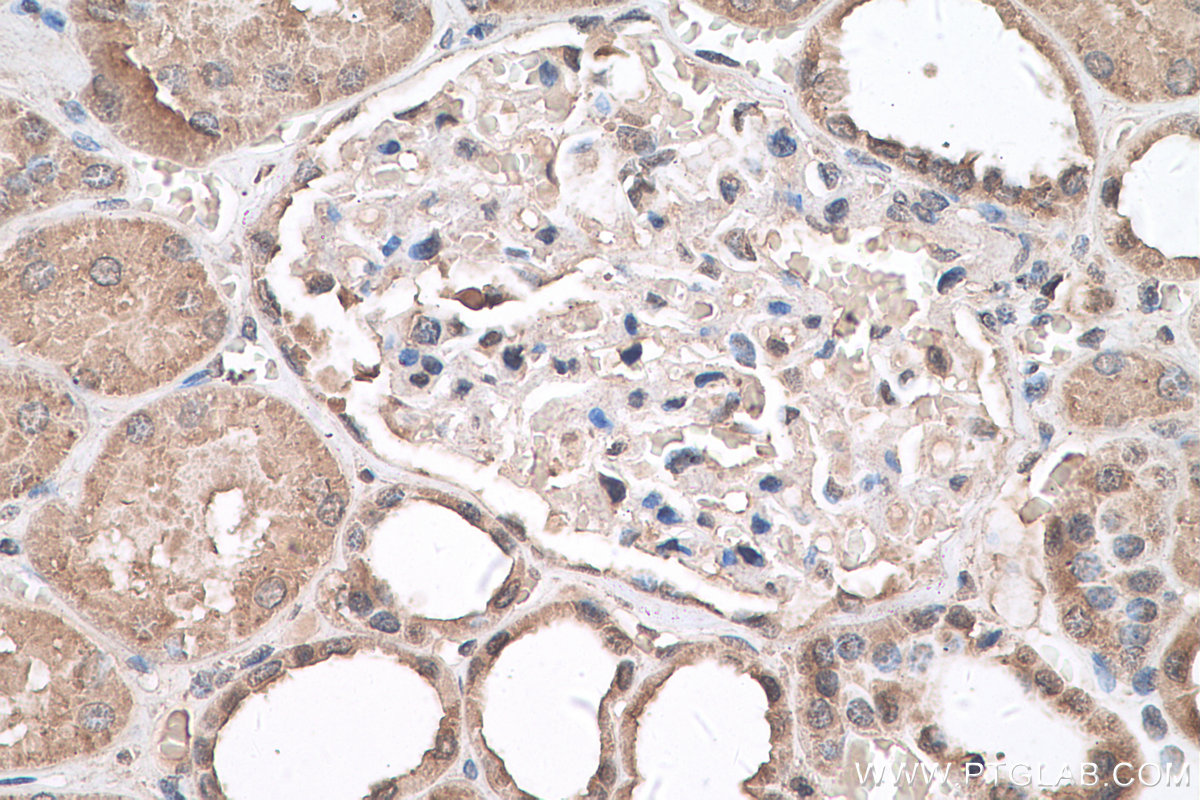 IHC staining of human kidney using 67949-1-Ig (same clone as 67949-1-PBS)