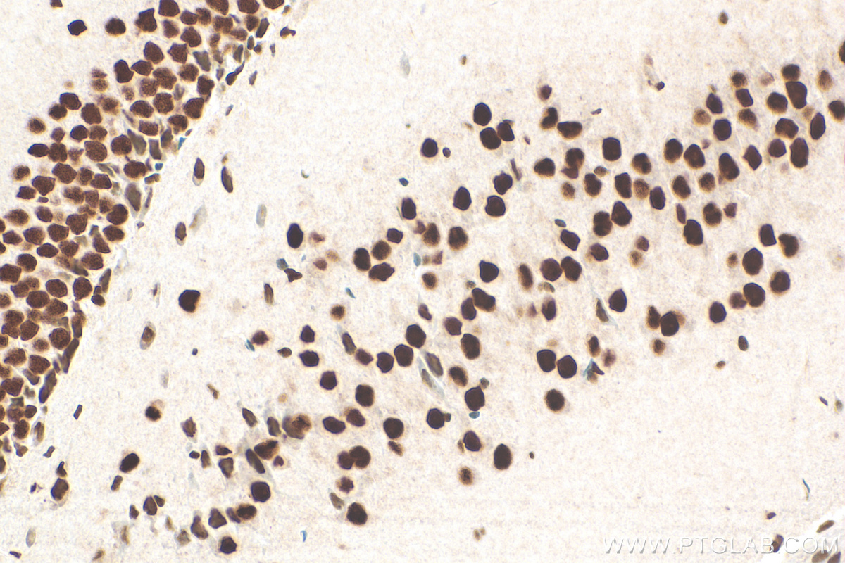 IHC staining of mouse brain using 12922-3-AP