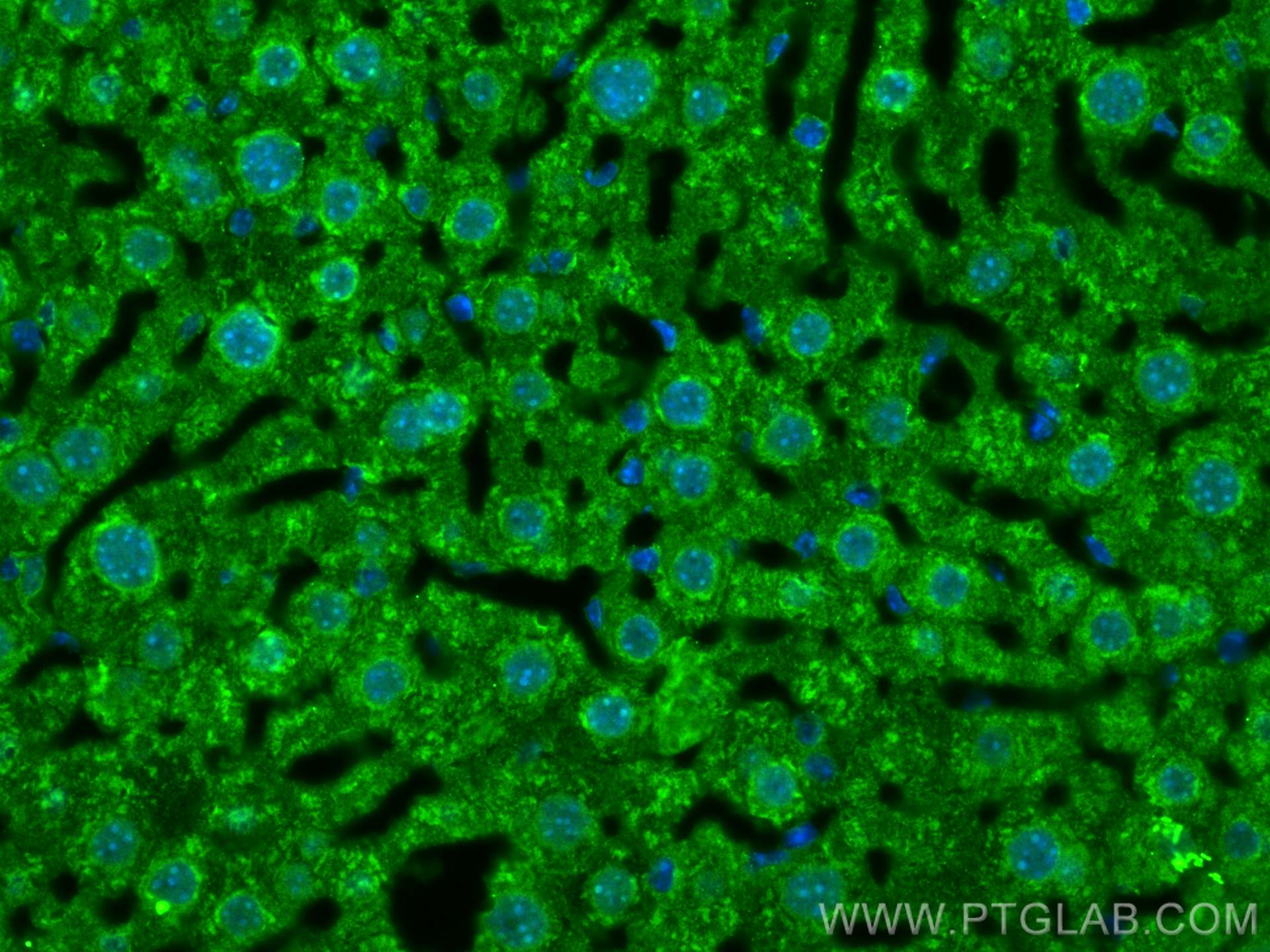 IF Staining of mouse liver using 17449-1-AP