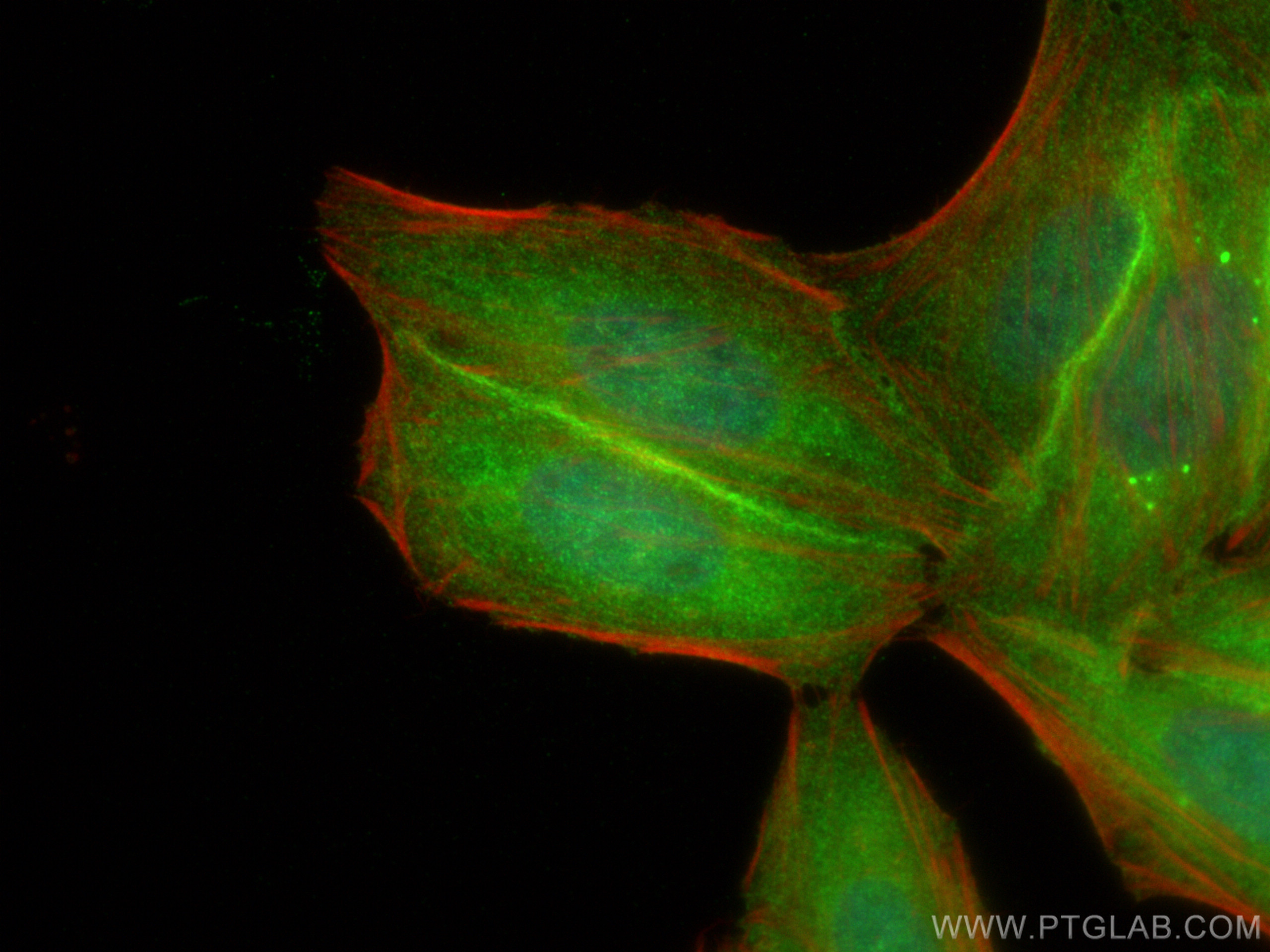 IF Staining of HepG2 using 29342-1-AP (same clone as 29342-1-PBS)