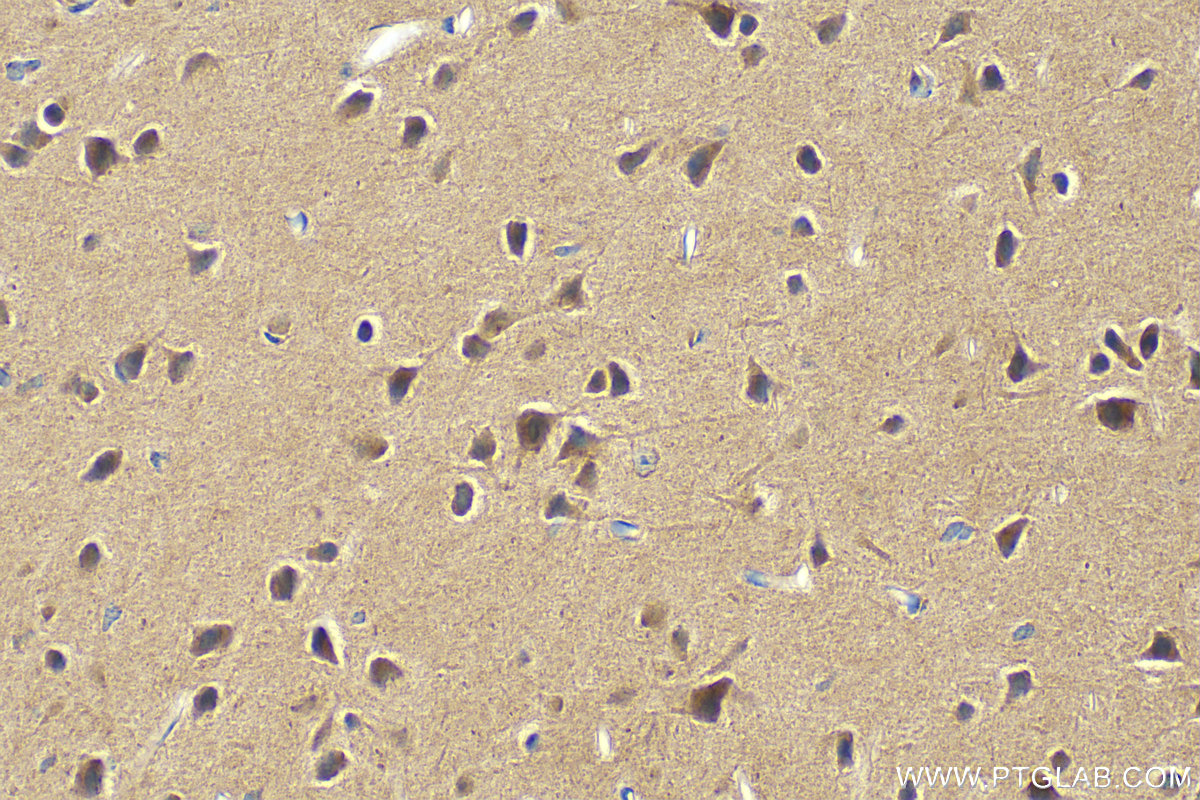 IHC staining of mouse brain using 29342-1-AP