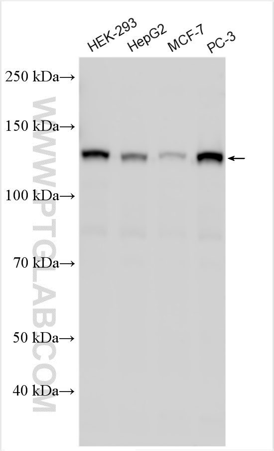 WB analysis using 29342-1-AP (same clone as 29342-1-PBS)