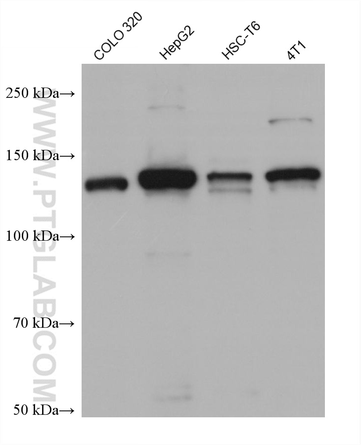 HDAC5