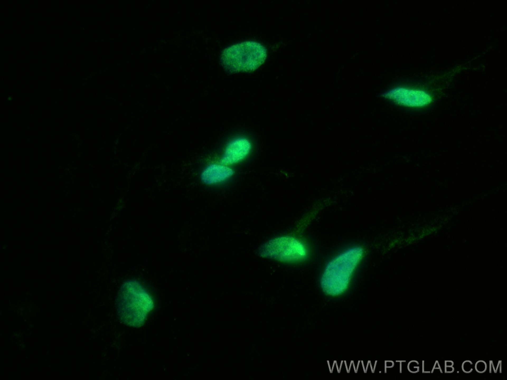 IF Staining of SH-SY5Y using 28334-1-AP