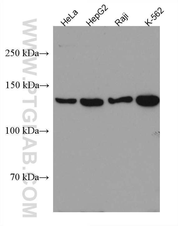 WB analysis using 67364-1-Ig