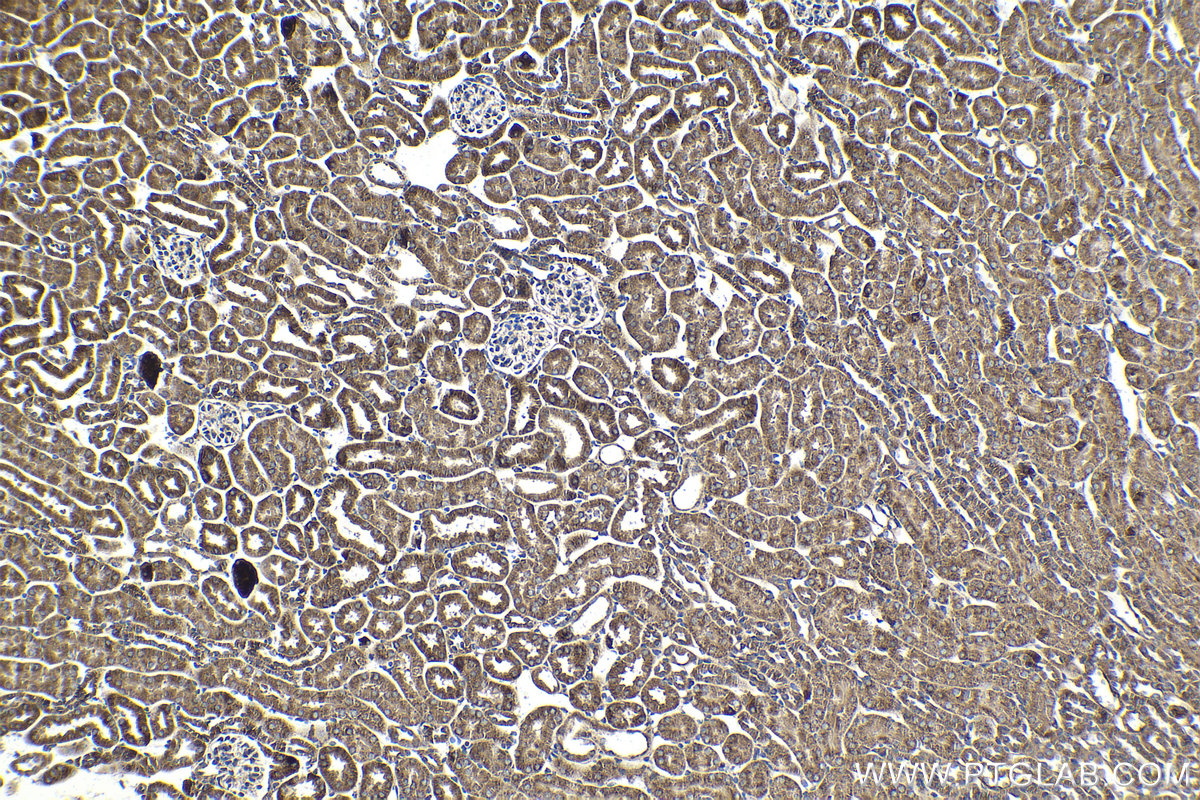 IHC staining of mouse kidney using 68391-1-Ig (same clone as 68391-1-PBS)