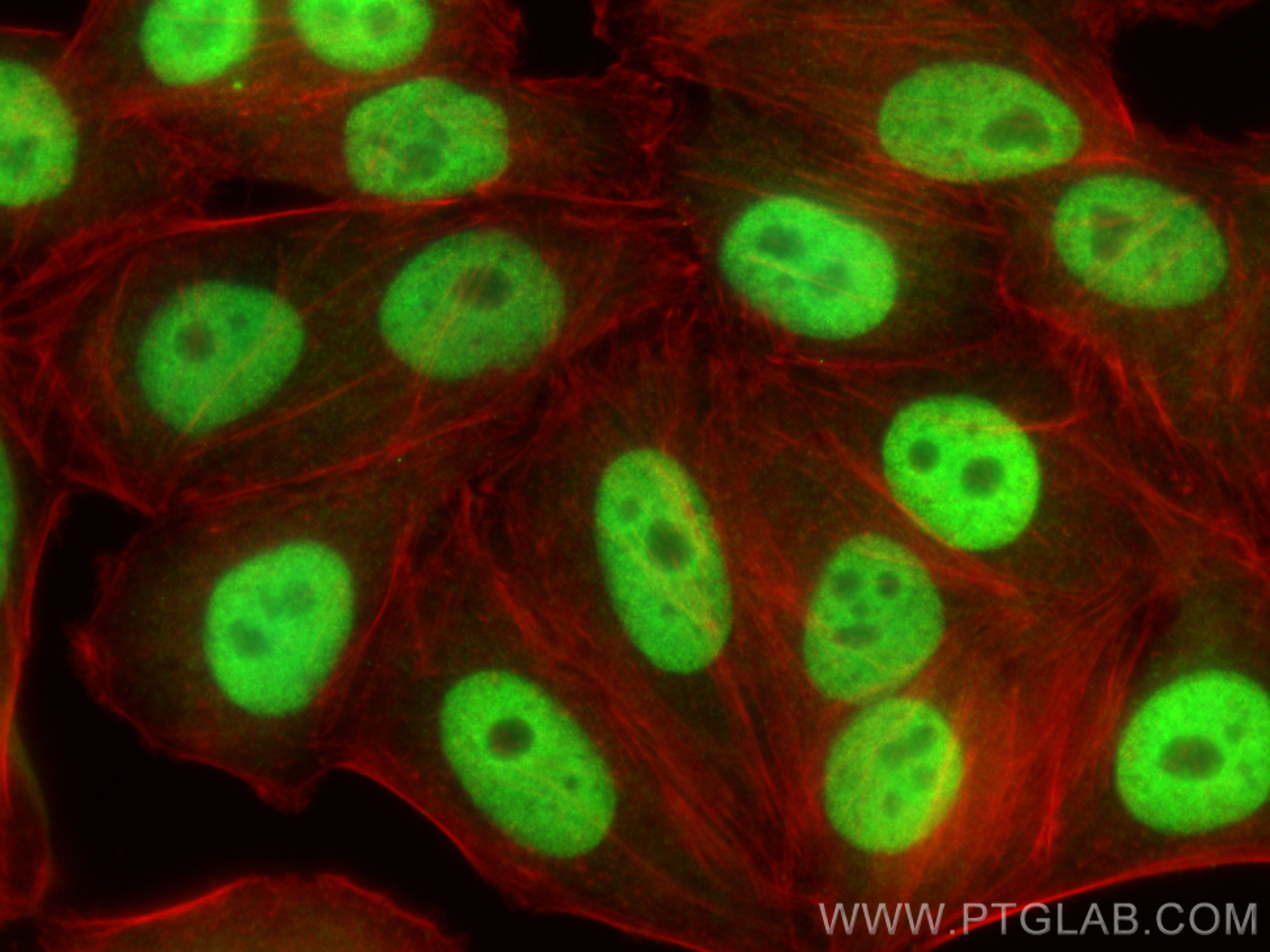 IF Staining of HepG2 using 15134-1-AP