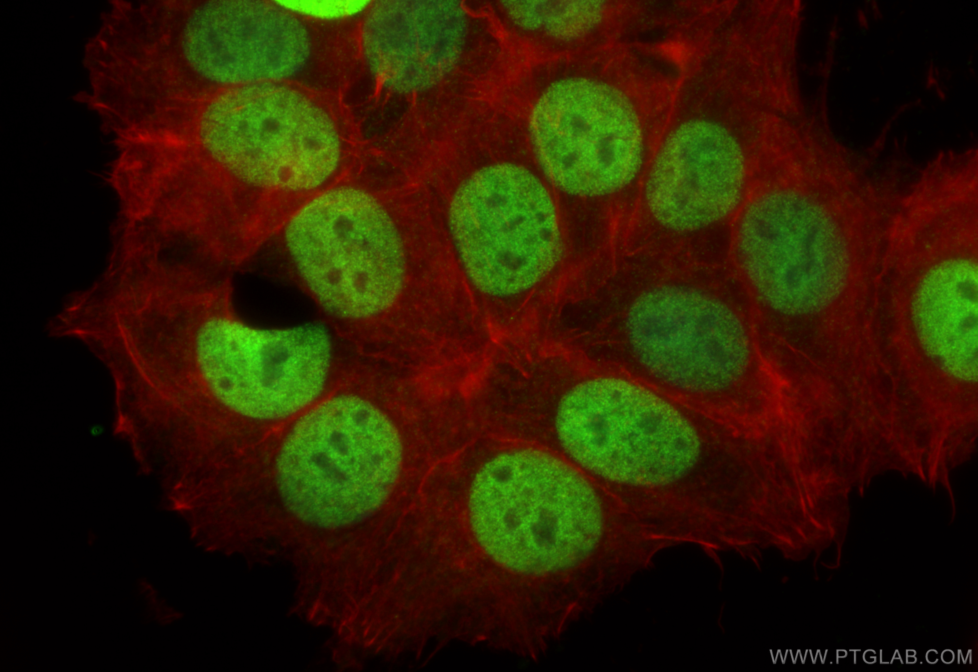 IF Staining of MCF-7 using 12380-1-AP