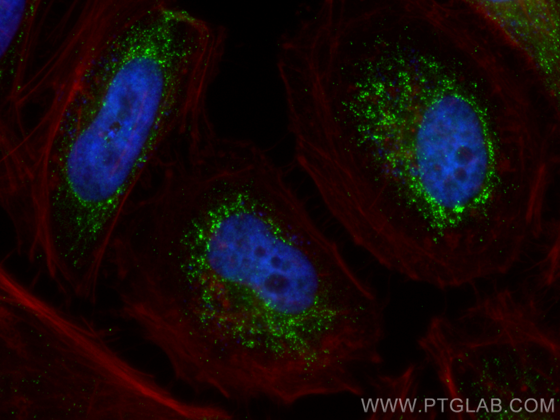 IF Staining of HeLa using 26147-1-AP